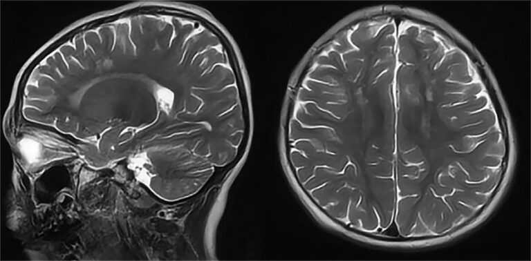 Convert DICOM to JPG/PNG using Python: Step-by-step guide to extract pixel data, rescale images, and save in common formats using pydicom, Pillow, and Numpy.