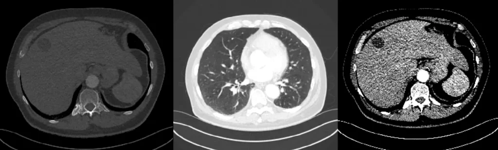 Adjusting Window Center and Width settings in CT scans for enhanced medical imaging clarity