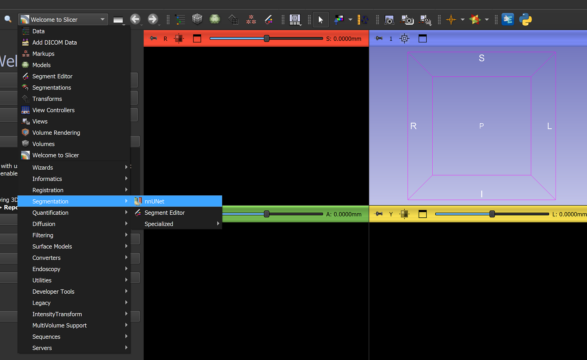 Installing nnUNet dependencies in 3D Slicer segmentation module