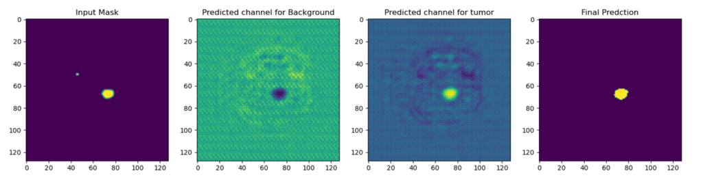 Introduction to deep learning liver segmentation using U-Net, MONAI, and PyTorch for medical imaging.