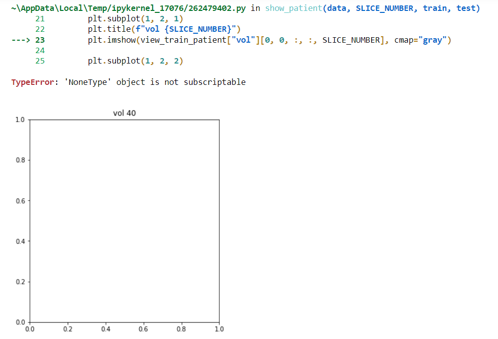 Common errors in MONAI for medical imaging: troubleshooting data paths, dictionary keys, and segmentation labels.