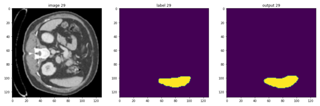 Automatic liver segmentation tutorial using MONAI and U-Net model for 3D medical imaging training and testing.