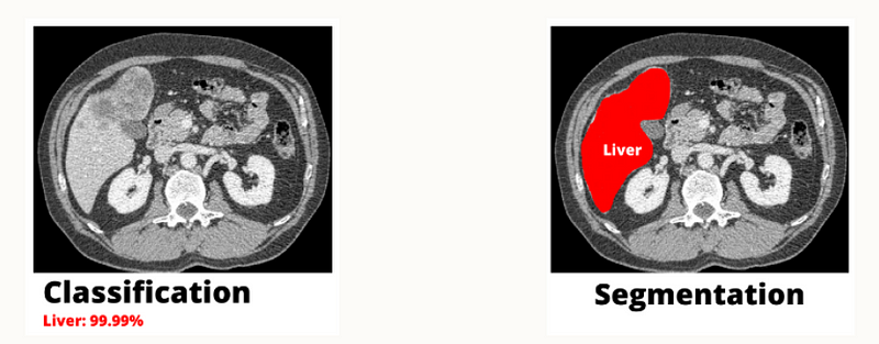 The difference between image classification and image segmentation.