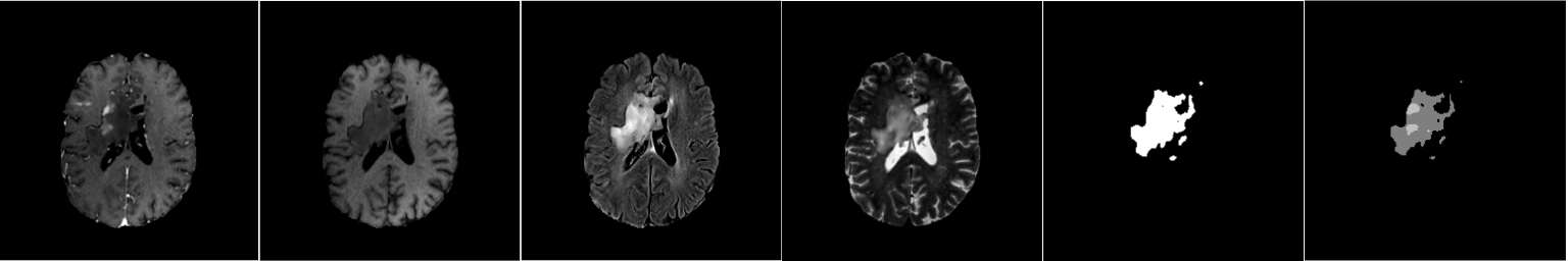 Synthetic medical imaging concept showcasing MRI, CT, and X-ray scans generated using Python and GAN models.