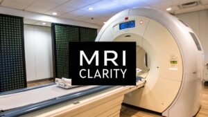 Understanding the resolution of MRI for Better Diagnostics - PYCAD ...