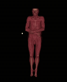 3D volume-rendered full-body CT scan rotating smoothly, showing skeletal and soft-tissue structures during interactive navigation.