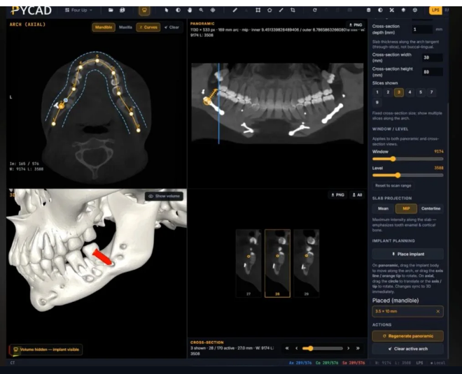 Multiplanar CBCT viewing in a dental DICOM viewer — axial, coronal, and sagittal.
