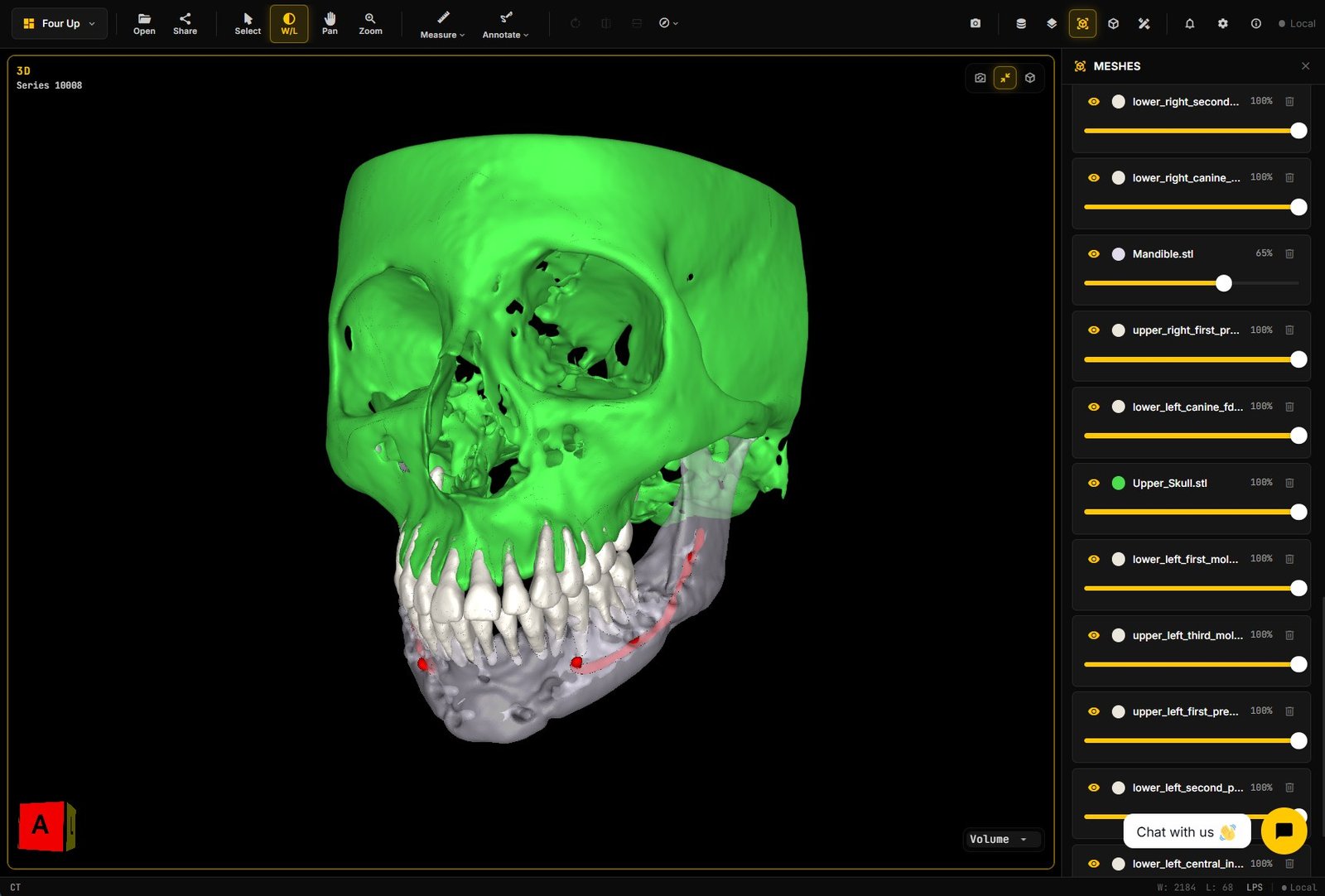 Canal mesh inside a semi-transparent mandible in 3D