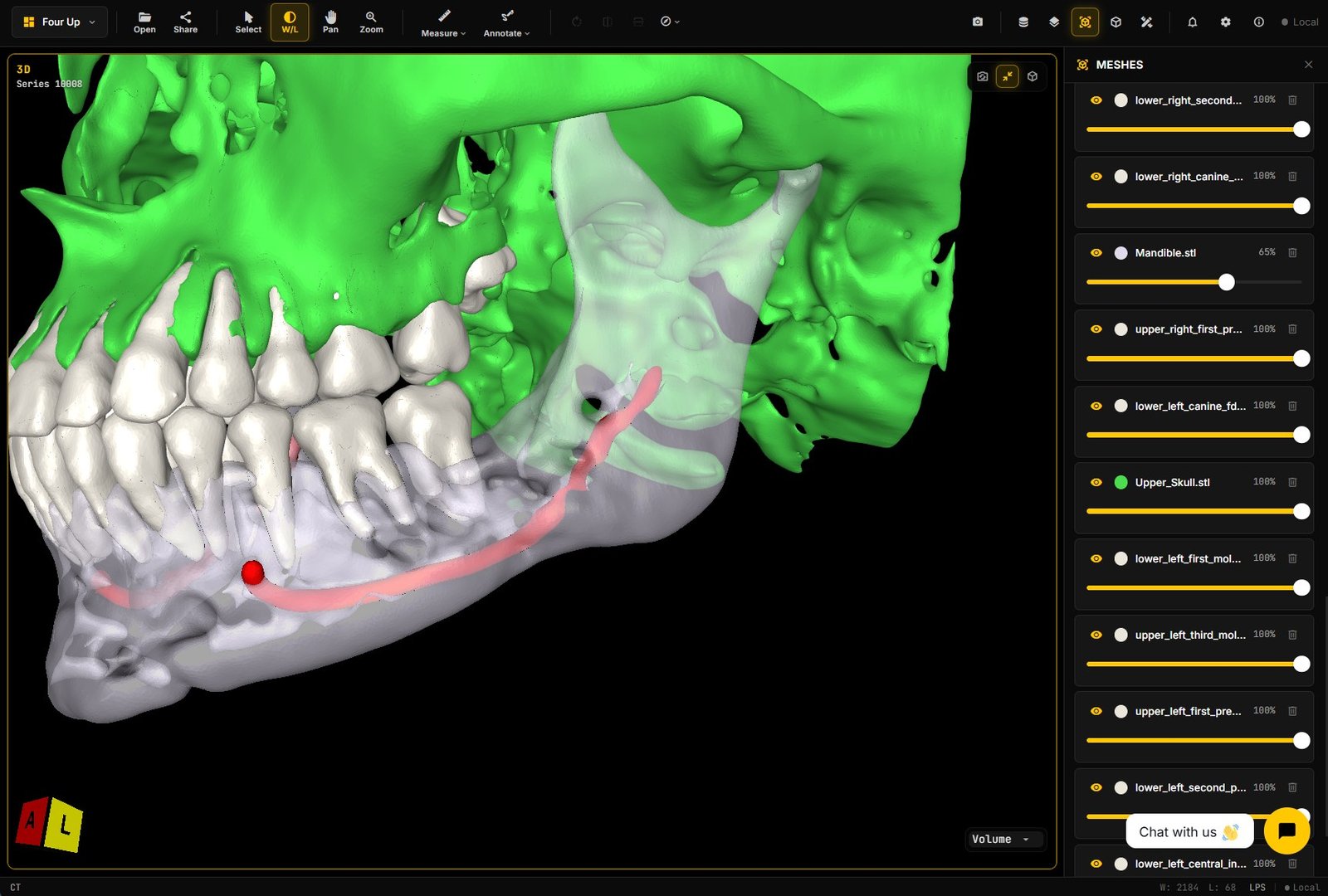 Meshes panel with Mandibular_canal.stl and per-structure opacity