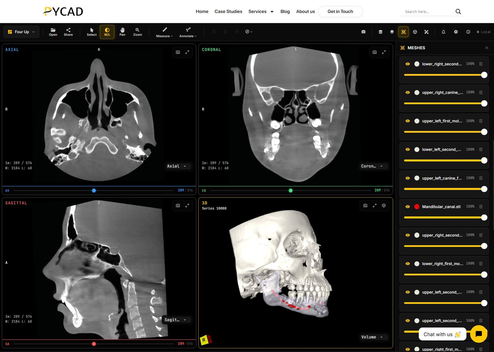 Four-up dental workspace — MPR plus 3D with specialty meshes.