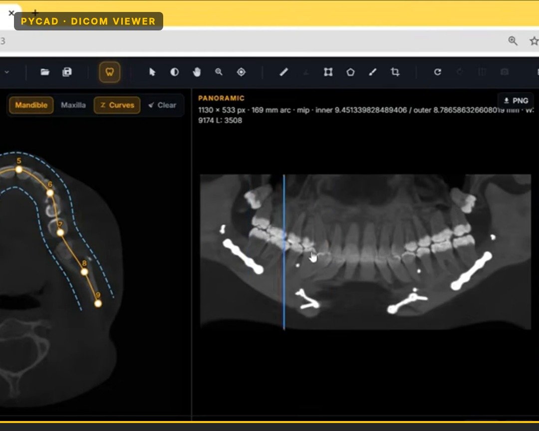 Dental viewer: mandible curve on CBCT with synchronized panoramic view.