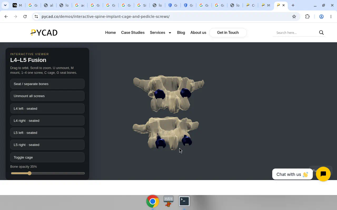Interactive spine cage and pedicle screws demo — orbit the construct.