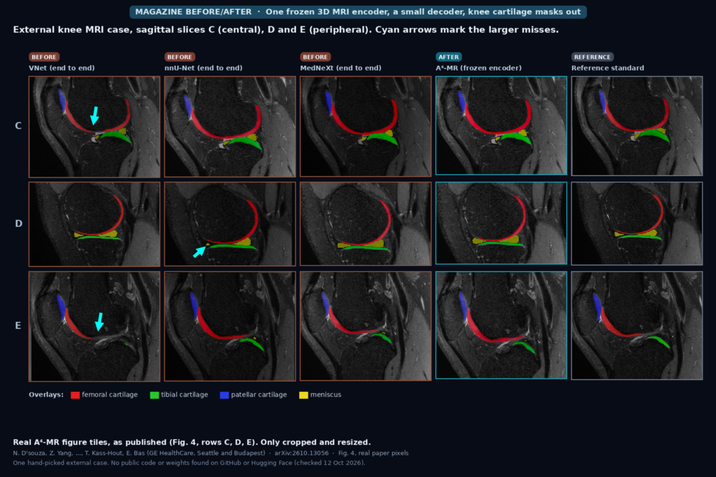 Sagittal knee MRI slices with femoral, tibial, patellar cartilage and meniscus overlays from VNet, nnU-Net, MedNeXt, A4-MR and the reference standard, cyan arrows on larger misses (D'souza, Bas et al., arXiv:2610.13056, Fig. 4)