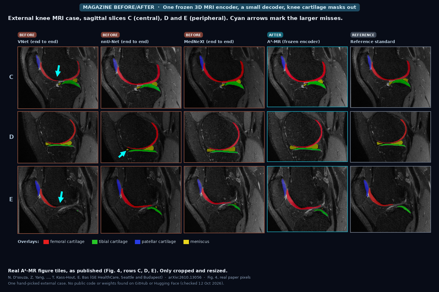 Sagittal knee MRI slices with femoral, tibial, patellar cartilage and meniscus overlays from VNet, nnU-Net, MedNeXt, A4-MR and the reference standard, cyan arrows on larger misses (D'souza, Bas et al., arXiv:2610.13056, Fig. 4)