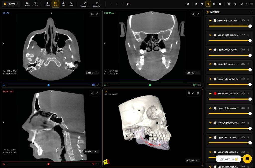 CBCT open in a browser with axial, coronal, sagittal and 3D views