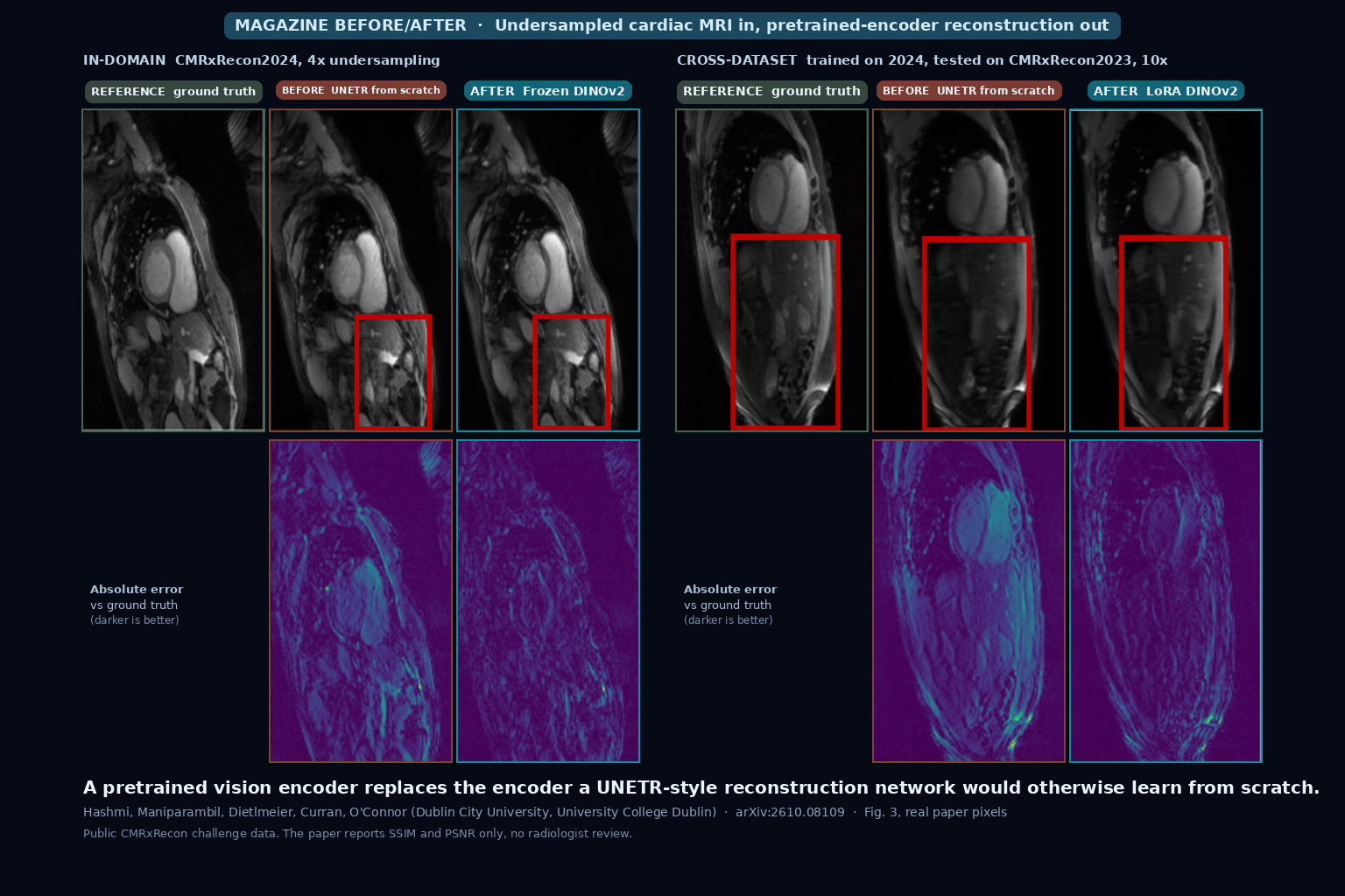 Two panels of cardiac MRI slices with absolute error maps below, each showing the ground truth, a UNETR trained from scratch, and a reconstruction from a pretrained DINOv2 encoder, at 4x acceleration in-domain and 10x acceleration across datasets (Hashmi et al., arXiv:2610.08109, Fig. 3)