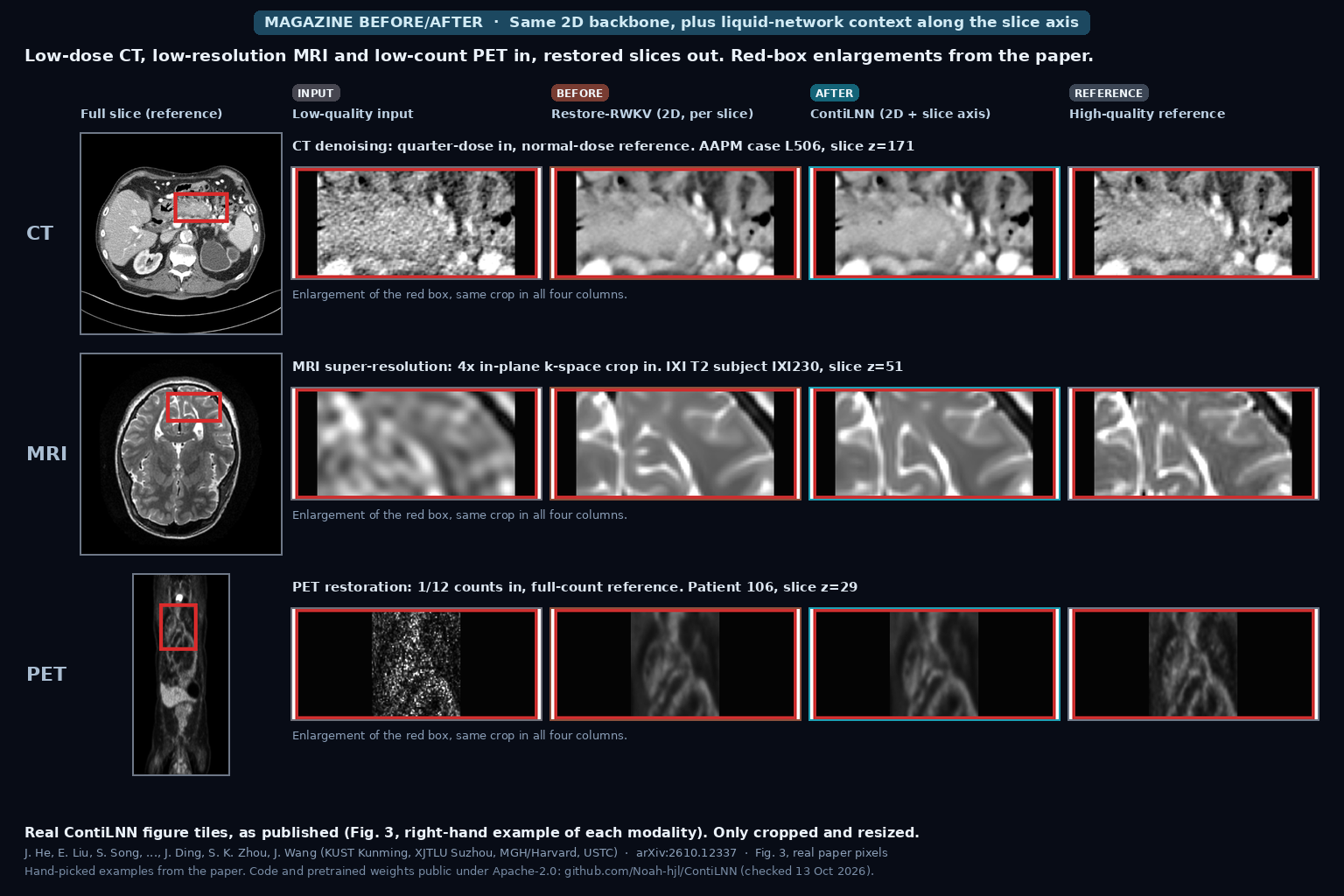 Red-box enlargements of a quarter-dose abdominal CT, a 4x k-space-cropped T2 brain MRI and a 1/12-count PET slice, each shown as low-quality input, Restore-RWKV output, ContiLNN output and high-quality reference, beside the full reference slice (He, Liu, Zhou, Wang et al., arXiv:2610.12337, Fig. 3)
