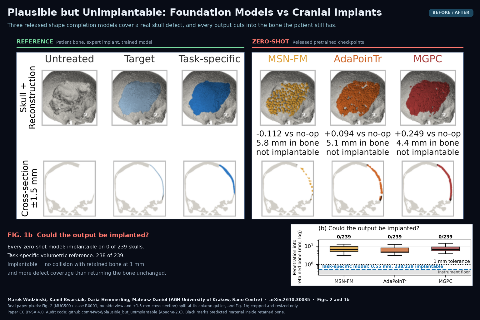 Figure 2 of arXiv:2610.30035 by Wodzinski, Kwarciak, Hemmerling and Daniol (AGH University of Krakow): a real craniectomy skull from MUG500+ with the expert target implant and a task-specific model beside the outputs of MSN-FM, AdaPoinTr and MGPC, each marked not implantable, plus Fig. 1b showing 0 of 239 implantable outputs per model.