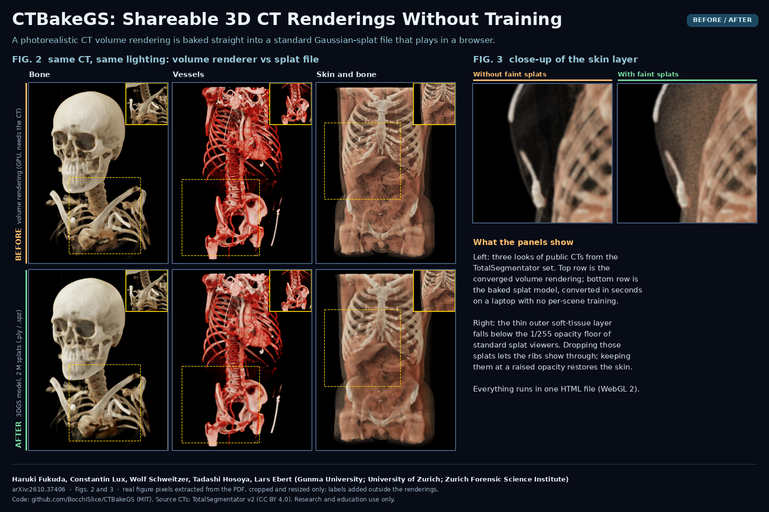 Figures 2 and 3 of arXiv:2610.37406 by Haruki Fukuda, Constantin Lux, Wolf Schweitzer, Tadashi Hosoya and Lars Ebert (Gunma University, University of Zurich, Zurich Forensic Science Institute): photorealistic CT volume renderings in bone, vessel and skin-and-bone looks next to the matching two-million-splat 3D Gaussian splatting models, and close-ups with and without faint splats.