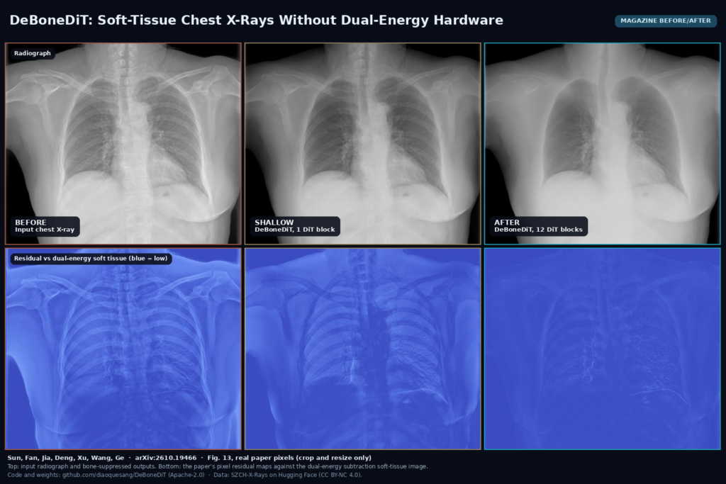 Magazine before/after from Fig. 13: an input chest X-ray beside DeBoneDiT bone-suppressed outputs with 1 and 12 DiT blocks, and below each the residual map against the dual-energy soft-tissue image. Sun, Fan et al., arXiv:2610.19466