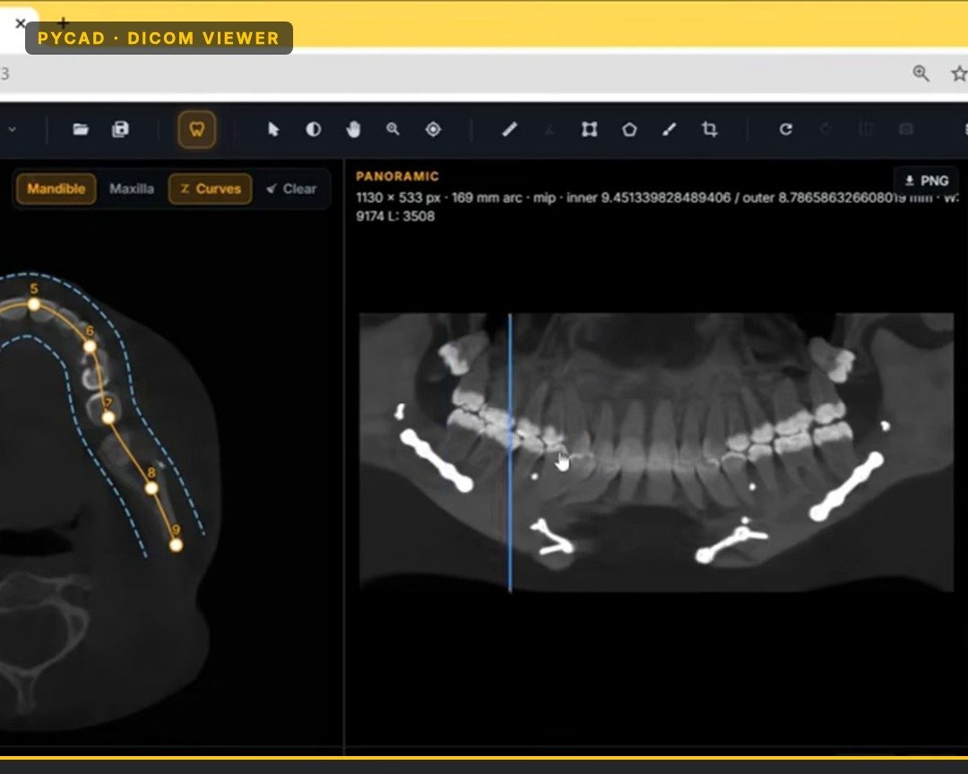 Panoramic workspace with arch curve and rebuilt panoramic in the dental viewer