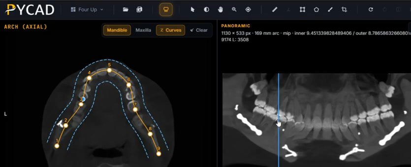 Axial CBCT slice with an editable arch of 9 numbered orange control points and a dashed blue corridor, next to the panoramic reconstructed along that arch