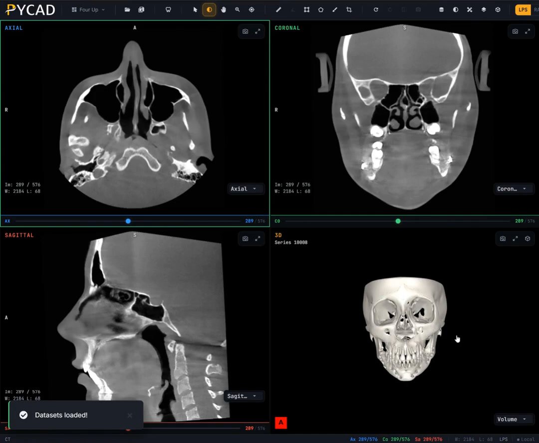 CBCT in four linked browser views, axial, coronal, sagittal and a 3D skull rendering, with a "Datasets loaded!" notice