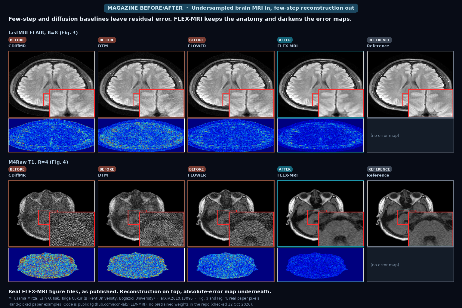 Brain MRI reconstructions at high acceleration: three few-step or diffusion baselines, FLEX-MRI, and the fully sampled reference, each with absolute-error maps (Mirza, Isik, Cukur, arXiv:2610.13095, Fig. 3 and Fig. 4)