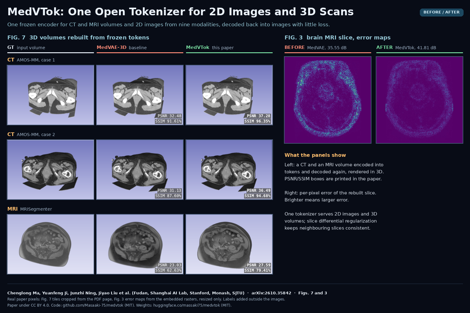 Figures 7 and 3 of arXiv:2610.35842 by Chenglong Ma, Yuanfeng Ji, Junzhi Ning, Jiyao Liu et al.: 3D renderings of two CT volumes and one MRI volume as ground truth, MedVAE-3D reconstruction and MedVTok reconstruction, next to brain MRI error maps for MedVAE and MedVTok.