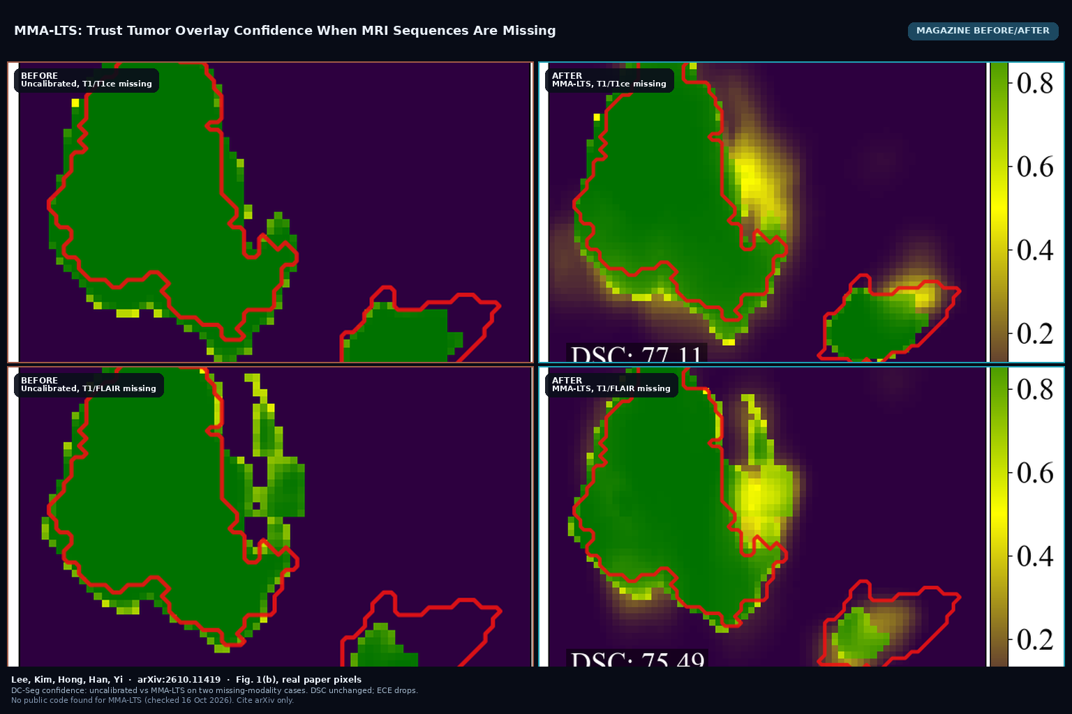 Magazine before/after from Fig. 1(b): DC-Seg uncalibrated confidence versus MMA-LTS for T1/T1ce missing (top) and T1/FLAIR missing (bottom). Lee et al., arXiv:2610.11419
