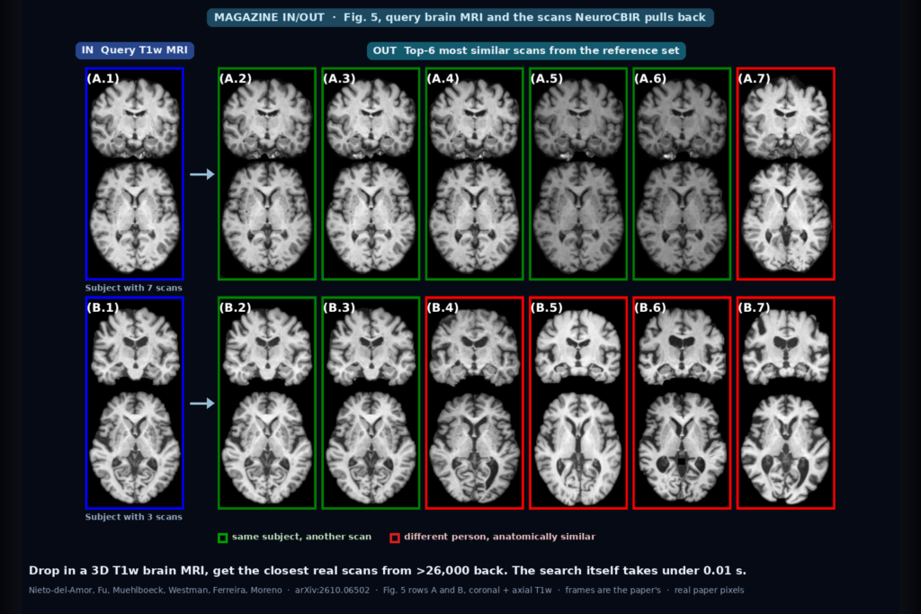 Two query T1w brain MRI scans in blue frames with their six most similar retrieved scans, green for the same subject and red for different subjects (Nieto-del-Amor et al., arXiv:2610.06502, Fig. 5)