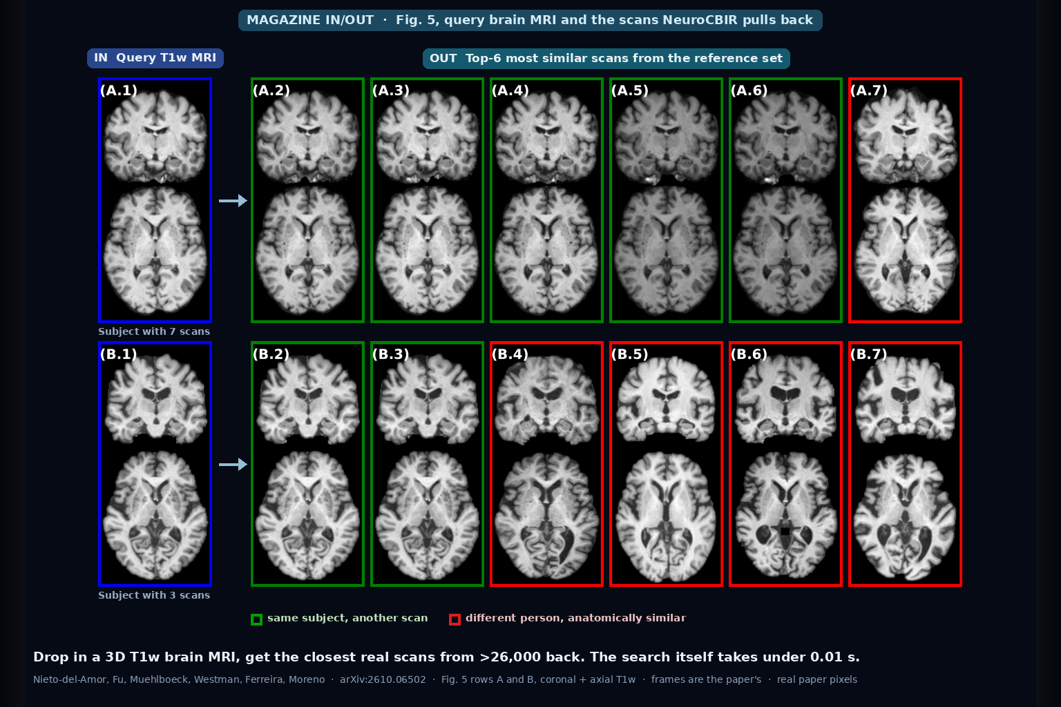 Two query T1w brain MRI scans in blue frames with their six most similar retrieved scans, green for the same subject and red for different subjects (Nieto-del-Amor et al., arXiv:2610.06502, Fig. 5)