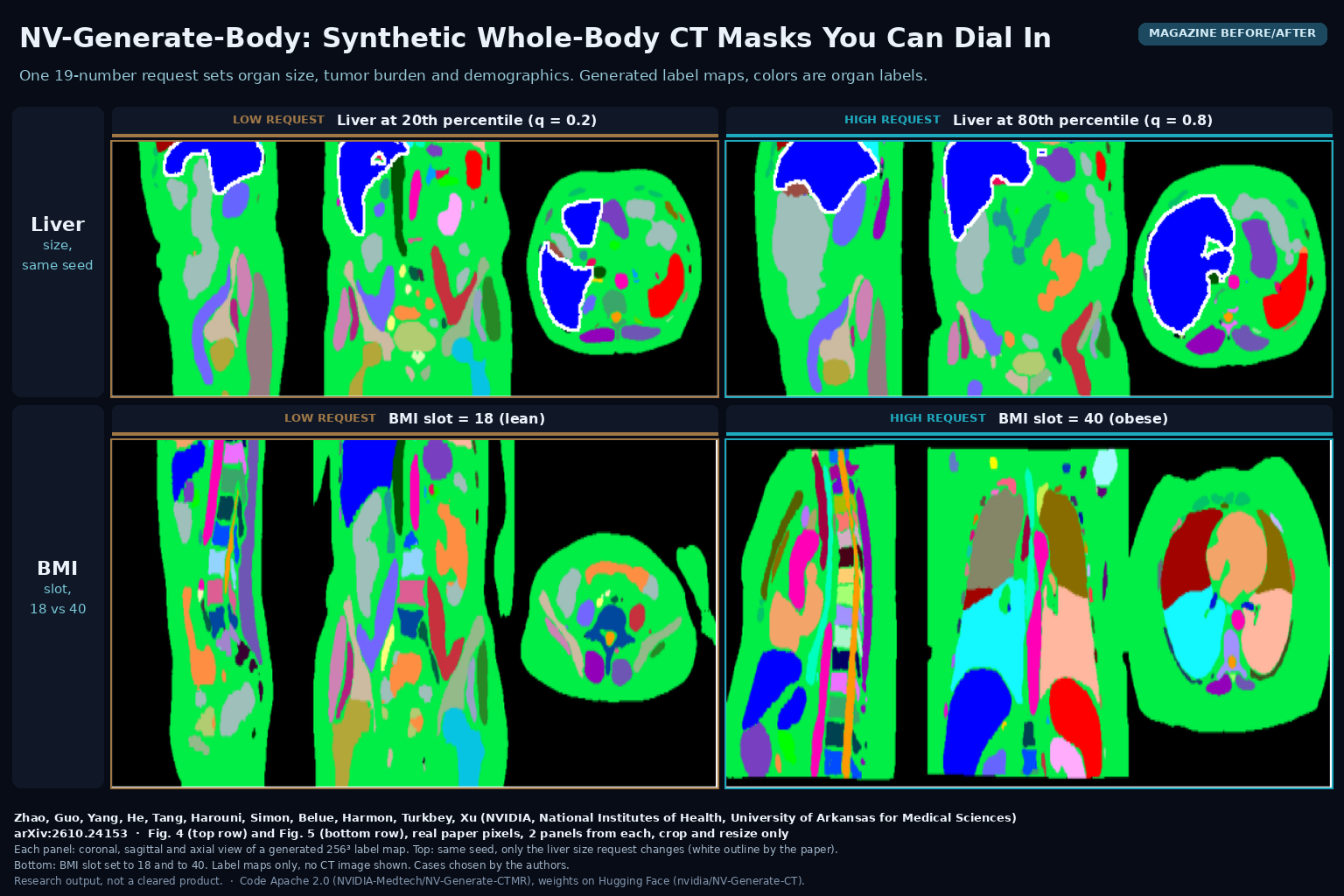 Magazine before/after from Figs. 4 and 5 of NV-Generate-Body: coronal, sagittal and axial views of generated 256-cube CT label maps, top row liver requested at the 20th and 80th percentile with the same seed, bottom row BMI slot set to 18 and 40. Zhao, Guo, ..., Turkbey, Xu, NVIDIA, NIH, UAMS, arXiv:2610.24153