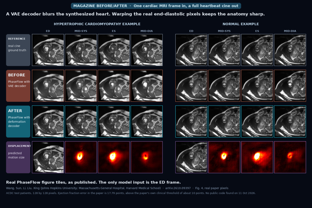 Cardiac MRI cine frames at end-diastole, mid-systole, end-systole and mid-diastole for a hypertrophic cardiomyopathy and a normal example: real cine on top, a blurry VAE-decoder result in the middle, a sharp deformation-decoder result below, and predicted displacement heat maps at the bottom (Wang et al., arXiv:2610.09397, Fig. 4)
