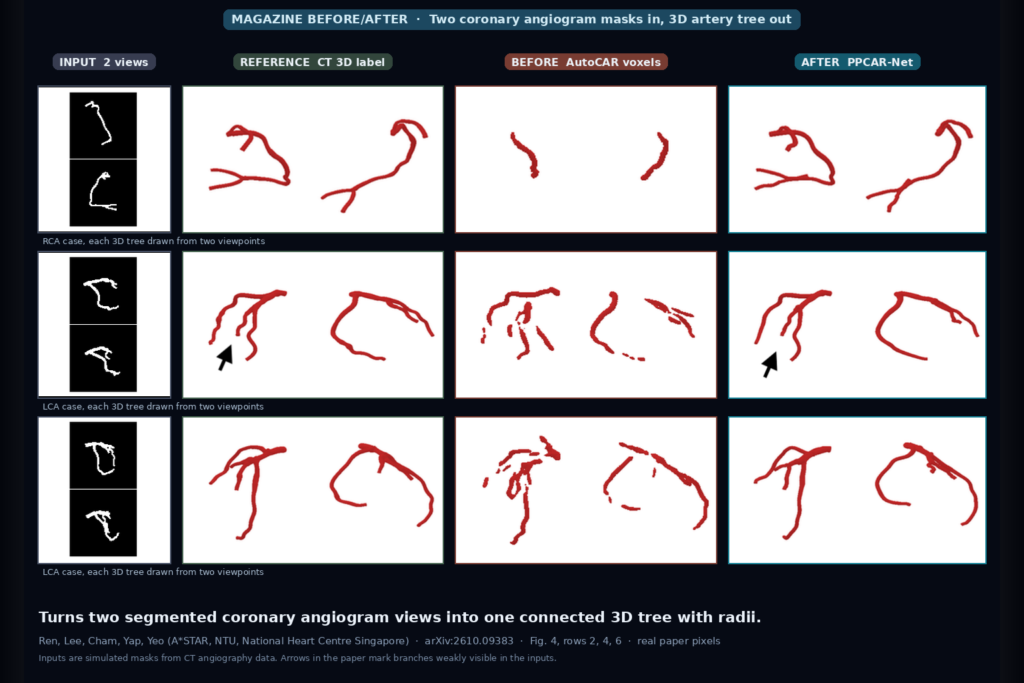 Rows of coronary artery cases: two segmented angiogram input masks, the CT 3D artery label, a fragmented AutoCAR voxel reconstruction, and the connected PPCAR-Net reconstruction (Ren et al., arXiv:2610.09383, Fig. 4)