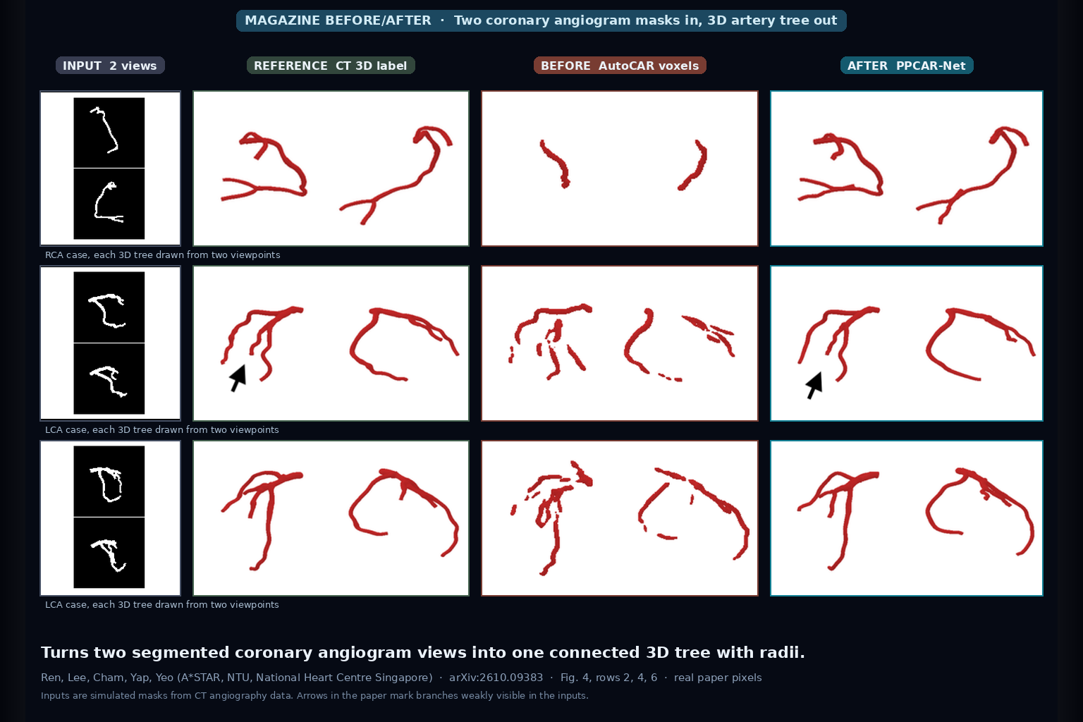 Rows of coronary artery cases: two segmented angiogram input masks, the CT 3D artery label, a fragmented AutoCAR voxel reconstruction, and the connected PPCAR-Net reconstruction (Ren et al., arXiv:2610.09383, Fig. 4)