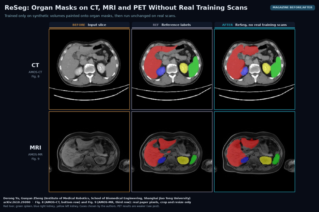 Magazine before/after grid from Figs. 8 and 9: an abdominal CT slice from AMOS-CT and an abdominal MRI slice from AMOS-MR, each shown as the input, the reference labels and the ReSeg prediction, with liver in red, spleen in green, right kidney in blue and left kidney in yellow. Derong Yu, Guoyan Zheng, Shanghai Jiao Tong University, arXiv:2610.29090