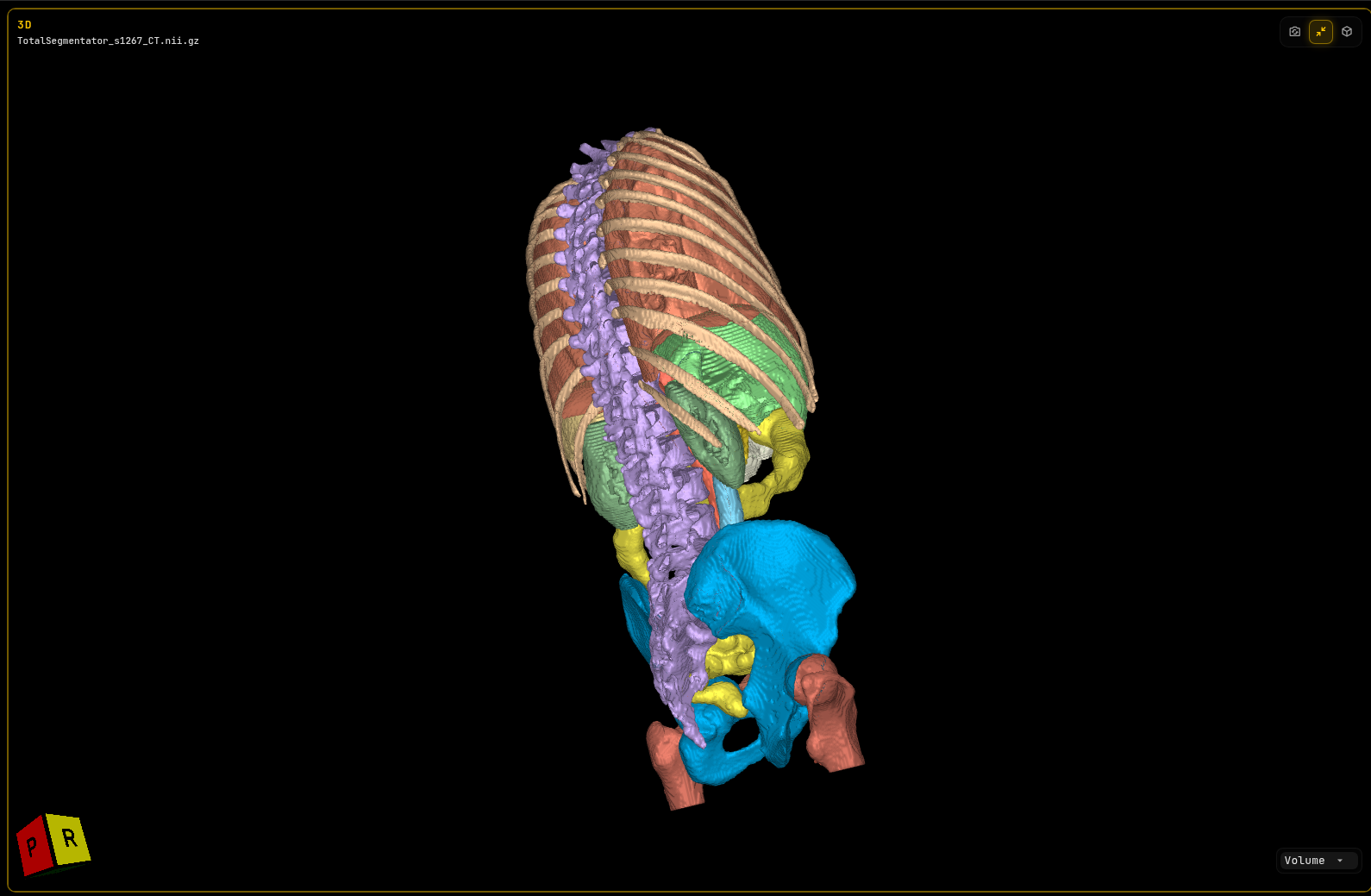 Maximized 3D view of a chest, abdomen and pelvis CT with segmented ribs, spine, pelvis and organs shown as colored surface models