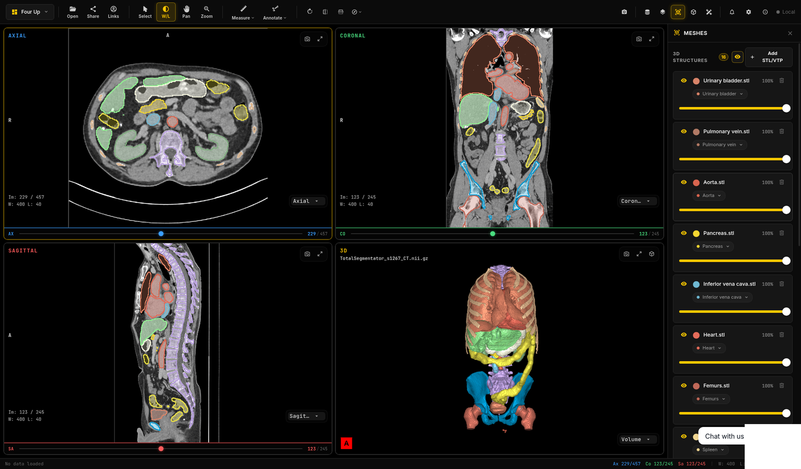 Viewer with the Meshes panel open, listing STL files such as urinary bladder, pulmonary vein, aorta, pancreas, inferior vena cava, heart and femurs, each linked to its label map, beside label-map outlines on the CT slices and the 3D model