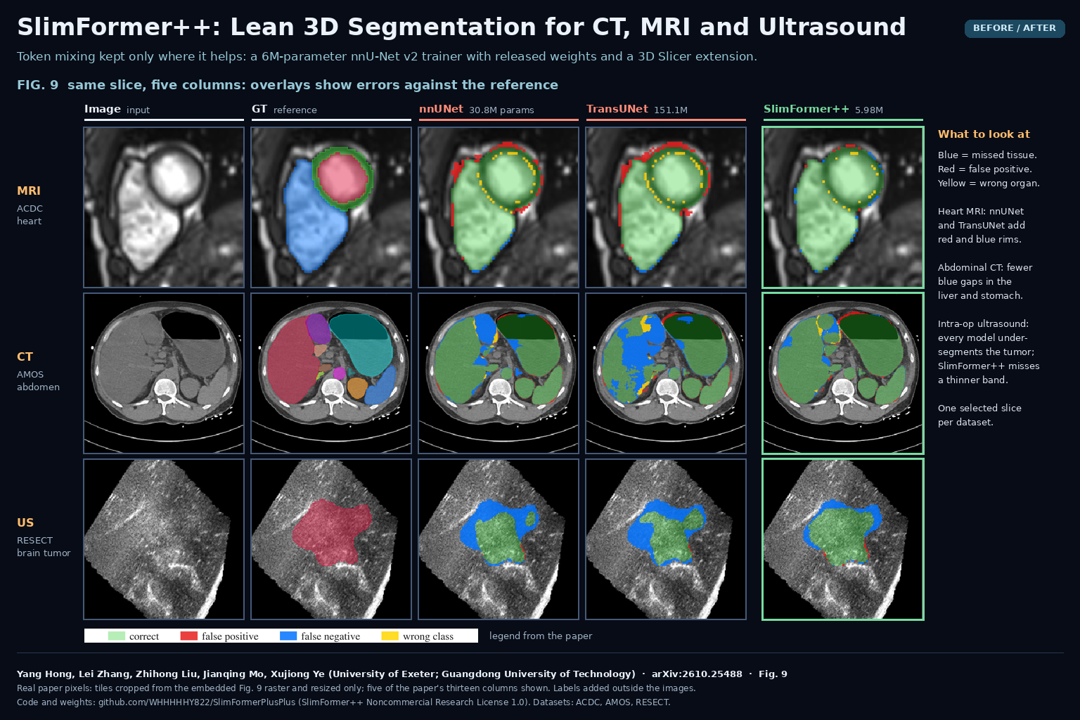 Figure 9 of arXiv:2610.25488 by Yang Hong, Lei Zhang, Zhihong Liu, Jianqing Mo and Xujiong Ye: cardiac MRI, abdominal CT and intraoperative brain ultrasound slices with ground truth and nnUNet, TransUNet and SlimFormer++ predictions, errors colored as false positive, false negative and wrong class.