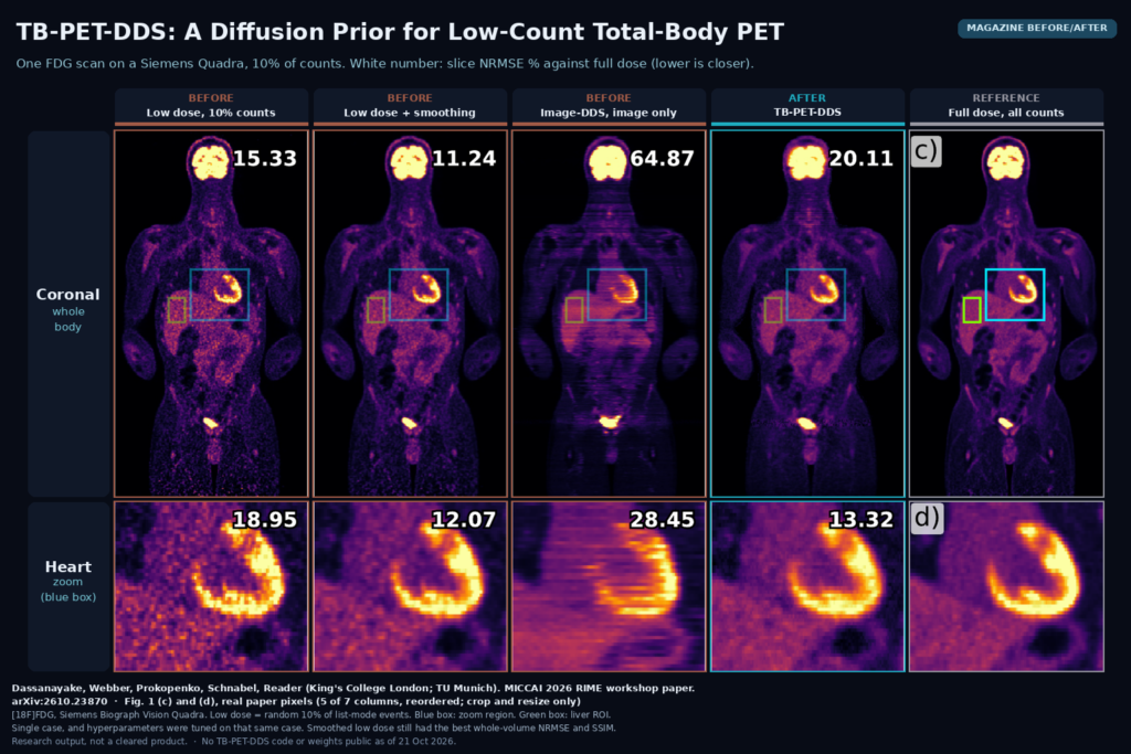 Magazine before/after from Fig. 1: one total-body FDG PET scan reconstructed from 10% of counts by the vendor, with smoothing, with Image-DDS and with TB-PET-DDS next to the full-dose reference, coronal view and heart zoom with slice NRMSE numbers. Dassanayake, Webber, Prokopenko, Schnabel, Reader, arXiv:2610.23870