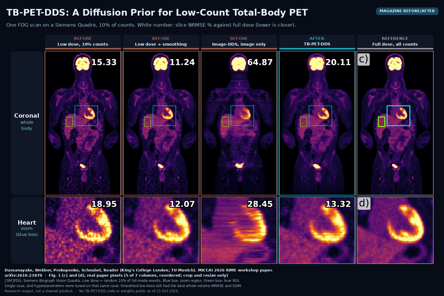 Magazine before/after from Fig. 1: one total-body FDG PET scan reconstructed from 10% of counts by the vendor, with smoothing, with Image-DDS and with TB-PET-DDS next to the full-dose reference, coronal view and heart zoom with slice NRMSE numbers. Dassanayake, Webber, Prokopenko, Schnabel, Reader, arXiv:2610.23870