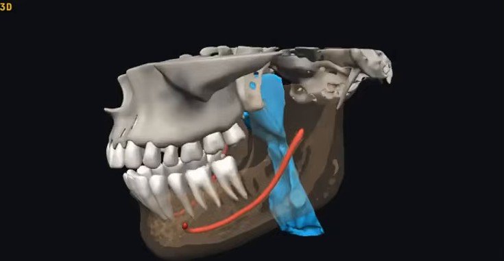 3D side view of a jaw from AI segmentation, with the mandibular canal in red, the airway in blue, the mandible semi-transparent and the teeth and upper skull in white