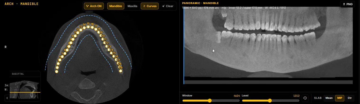 Axial CBCT slice of the mandible with an automatically generated arch of numbered control points and a dashed corridor, next to the panoramic reconstructed along it with window and level sliders