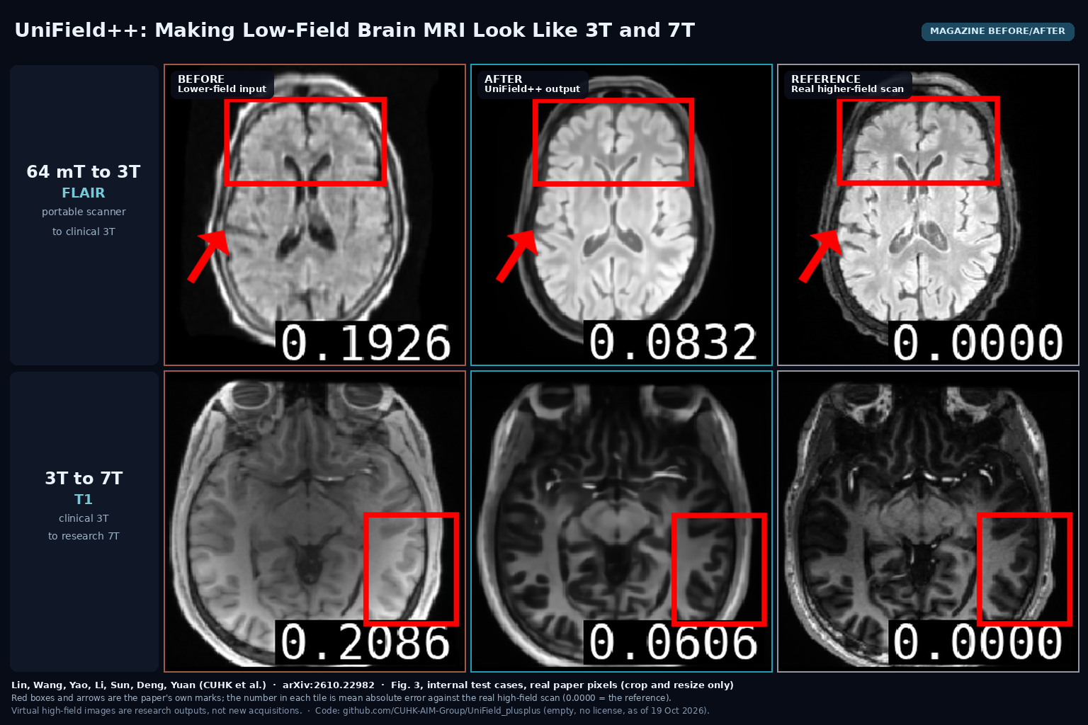 Magazine before/after from Fig. 3: two brain MRI test cases, a 64 mT FLAIR and a 3T T1, each shown as the lower-field input, the UniField++ virtual higher-field output and the real 3T or 7T scan. Lin, Wang, Yao, Li, Sun, Deng, Yuan, arXiv:2610.22982
