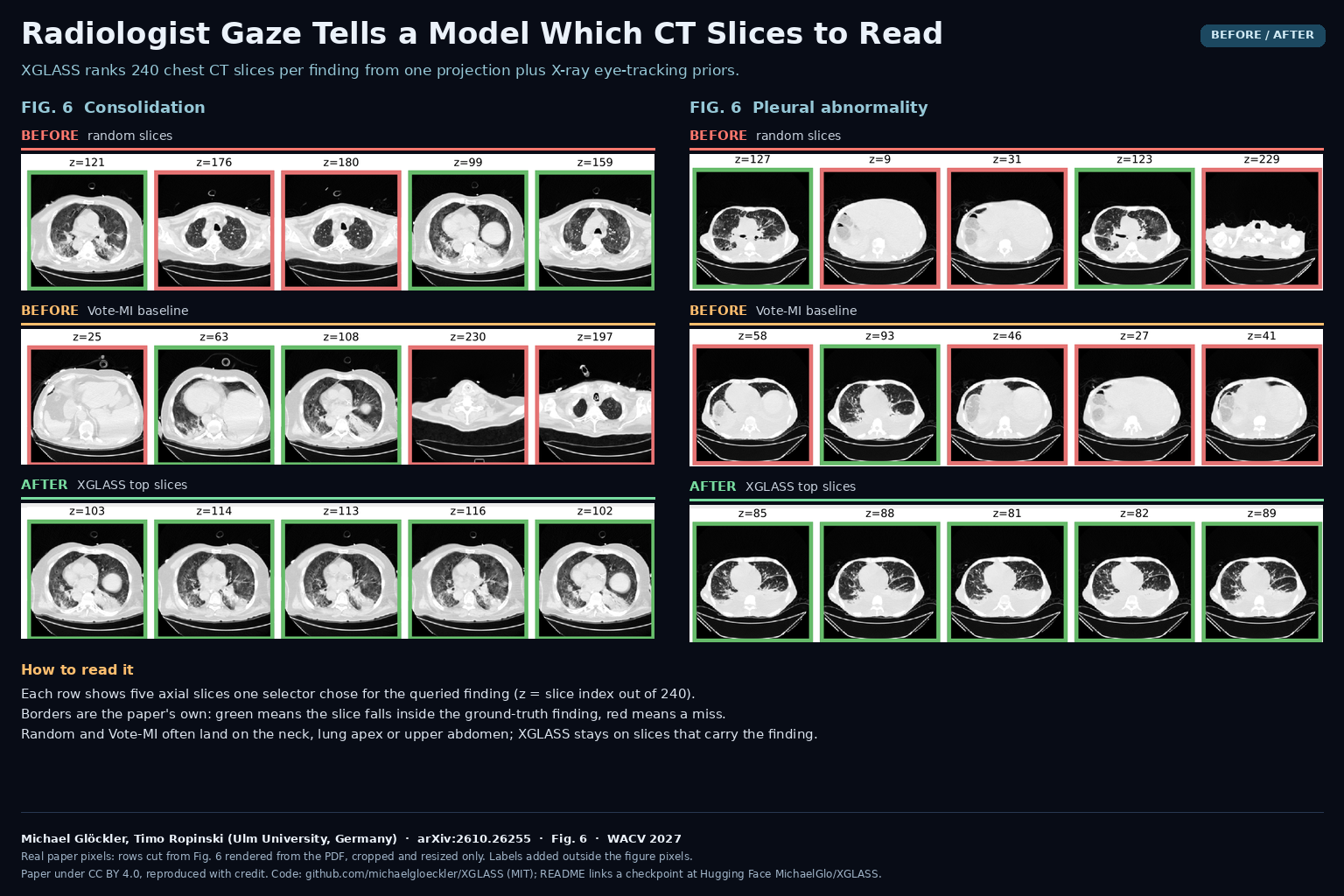 Figure 6 of arXiv:2610.26255 by Michael Glöckler and Timo Ropinski (Ulm University): five axial chest CT slices chosen by random selection, by Vote-MI and by XGLASS for consolidation and for pleural abnormality, with green borders on slices inside the ground-truth finding and red borders on misses.